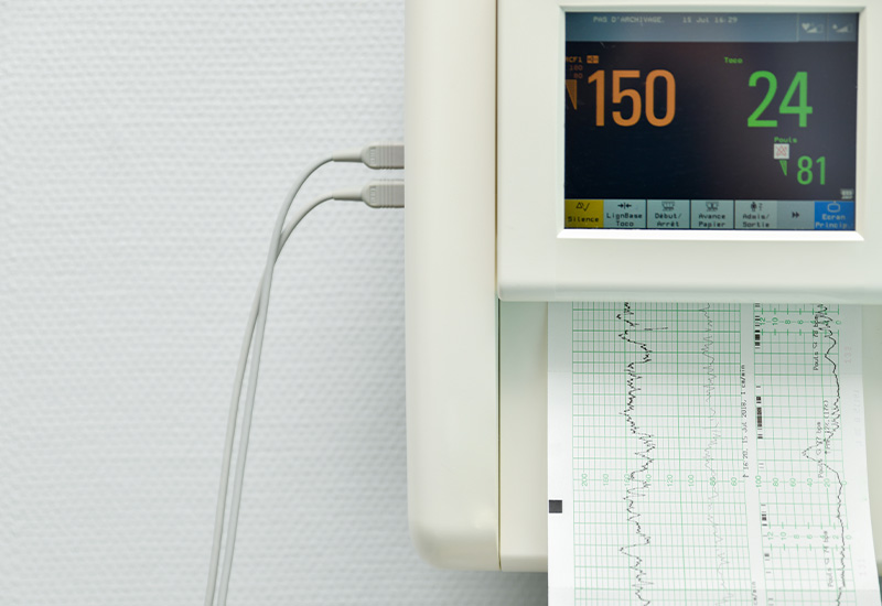 ecg