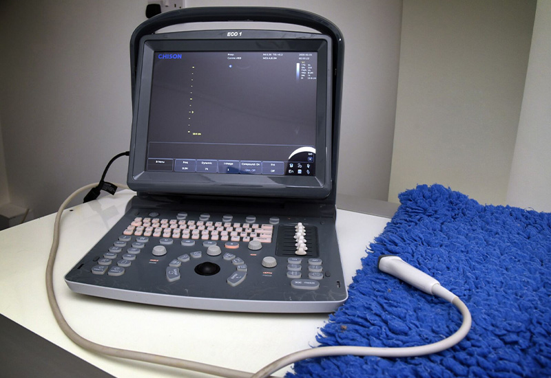 ultrasound
